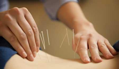 CURSO ACUPUNTURA acreditado por APTN-COFENAT