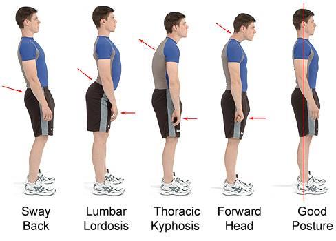 CHARLA: REEQUILIBRIO POSTURAL EN LAS ACTIVIDADES DIARIAS