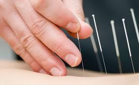 ACUPUNTURA PARA ADELGAZAR: 1A SESIÓN GRATUITA