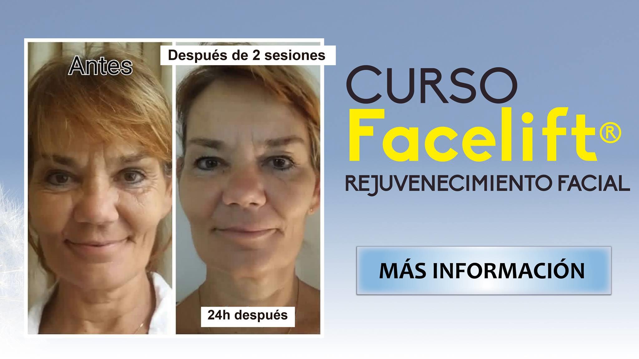 Sesiones Individuales de Facelift